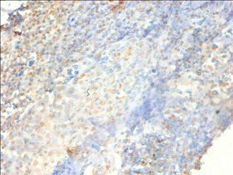 PSME3 Antibody