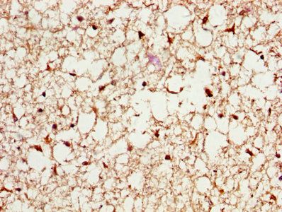 PSME3 Antibody