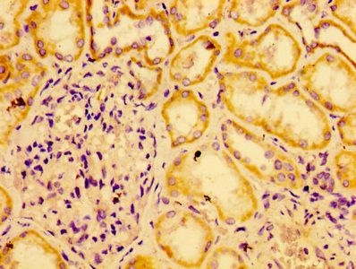 AGO2 Antibody