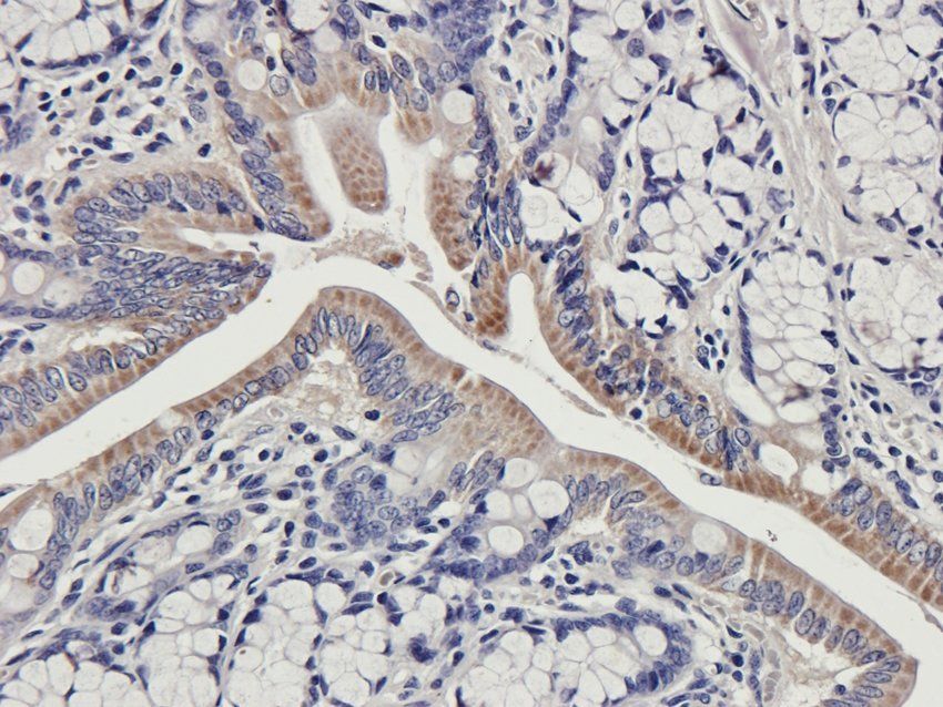 Protein FEV Rabbit Polyclonal Antibody