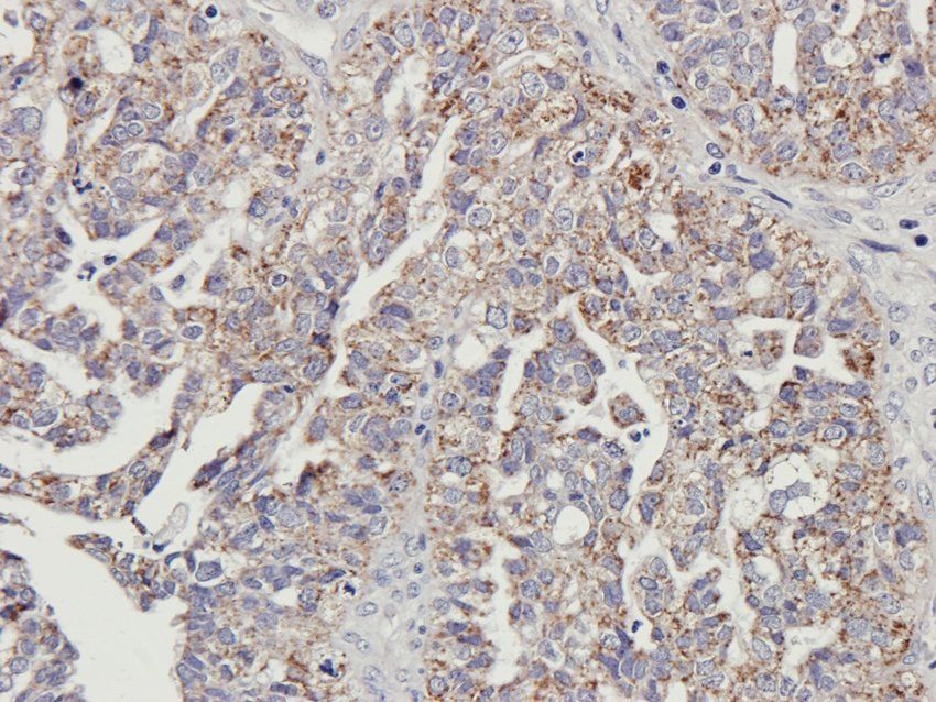 Protein FEV Rabbit Polyclonal Antibody