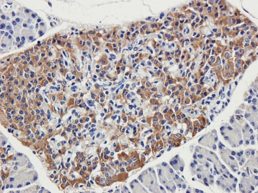 Protein FEV Rabbit Polyclonal Antibody