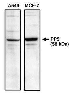 Rabbit anti Human Protein Phosphatase 5 (C Terminal) Antibody