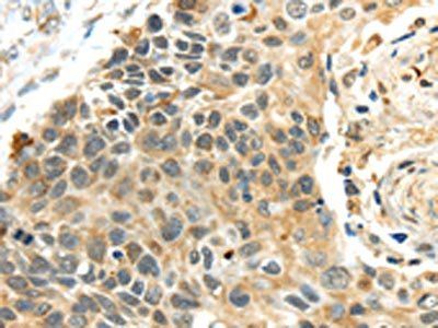PROX1 Antibody