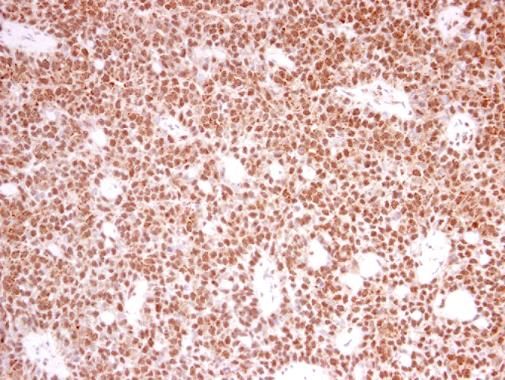 PRPF39 Rabbit Polyclonal Antibody
