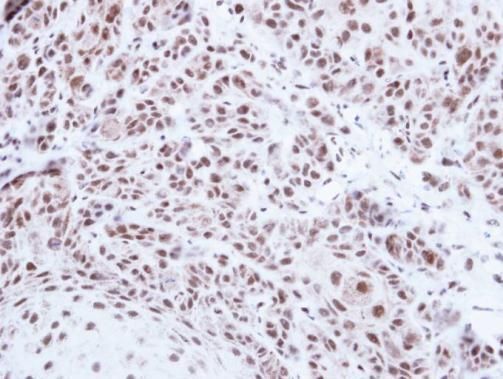 PRPF39 Rabbit Polyclonal Antibody