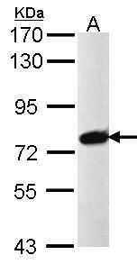 PRPF39 Rabbit Polyclonal Antibody