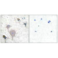 PRPH Antibody