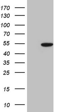 TP53RK Antibody