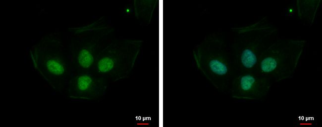 PRPS1L1 Rabbit Polyclonal Antibody