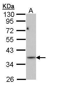 PRPS1L1 Rabbit Polyclonal Antibody