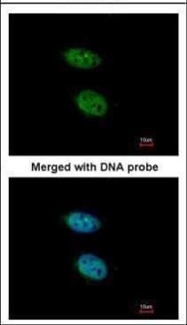 PRPS2 Rabbit Polyclonal Antibody
