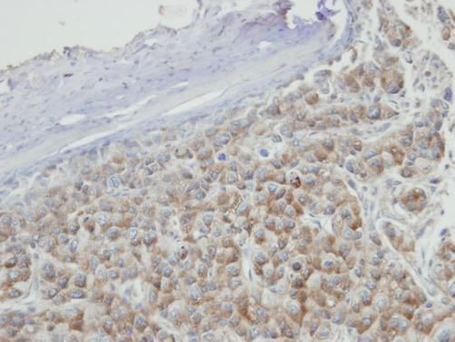 PRPS2 Rabbit Polyclonal Antibody