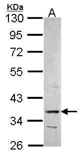 PRPS2 Rabbit Polyclonal Antibody
