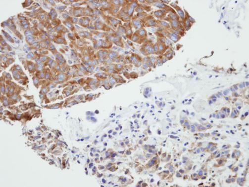 PRPSAP2 antibody [N1C3]