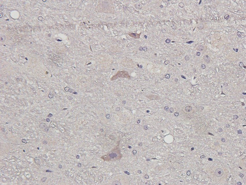 PRRT1 Rabbit Polyclonal Antibody