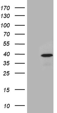 PRRT2 Antibody