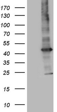 PRRX1 Antibody