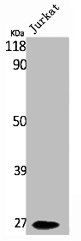 PRRX1 Antibody