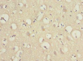 PRUNE2 Antibody