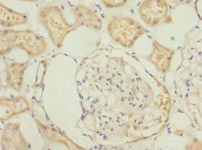 PRUNE2 Antibody