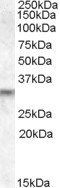 PRUNE2/BMCC1 Antibody