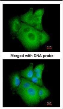 PSAT1 Rabbit Polyclonal Antibody