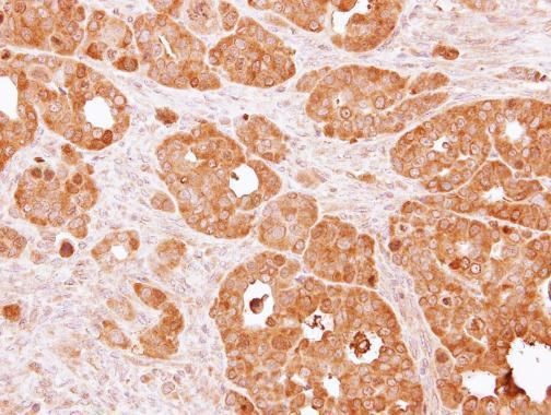 PSAT1 Rabbit Polyclonal Antibody