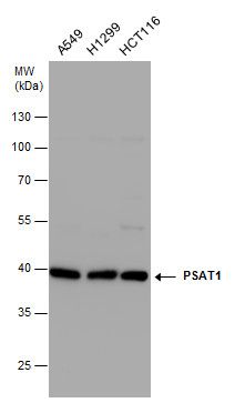 PSAT1 Rabbit Polyclonal Antibody