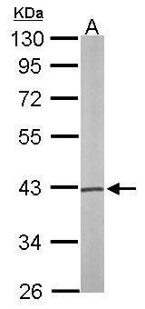 PSAT1 Rabbit Polyclonal Antibody
