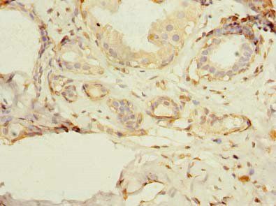 PSD4 Antibody