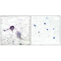 PSEN1 Antibody