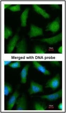 proteasome subunit alpha 6 Antibody