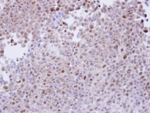 proteasome subunit alpha 7 Antibody