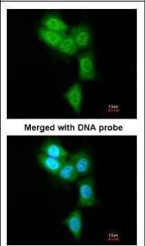 PSMB8 Rabbit Polyclonal Antibody