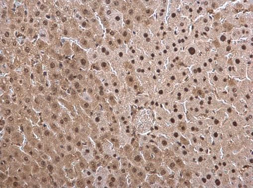 PSMB8 Rabbit Polyclonal Antibody