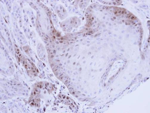 PSMB8 Rabbit Polyclonal Antibody