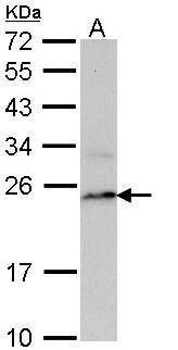 PSMB8 Rabbit Polyclonal Antibody