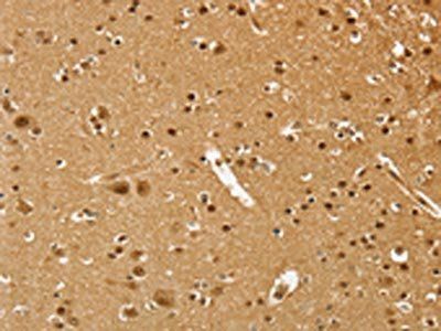 PSMC1 Antibody