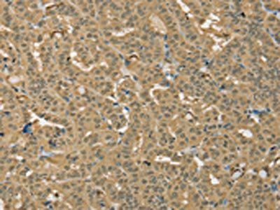 PSMC1 Antibody