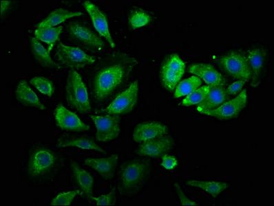 PSMC3 Antibody