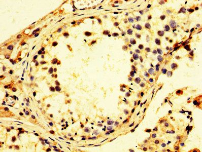PSMC3 Antibody