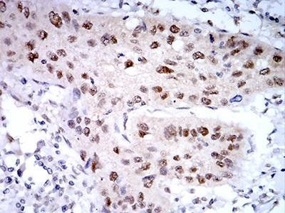 PSMC3 Antibody