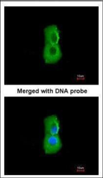 PSMC3 Rabbit Polyclonal Antibody