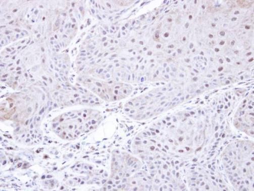 PSMC3 Rabbit Polyclonal Antibody