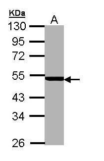 PSMC3 Rabbit Polyclonal Antibody