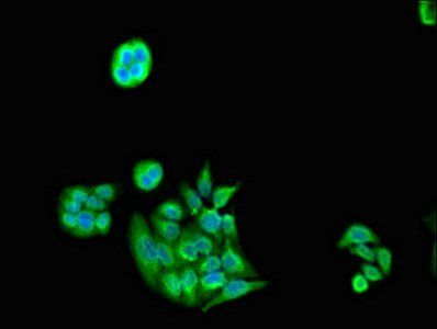 PSMC5 Antibody