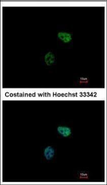 PSMC6 Rabbit Polyclonal Antibody