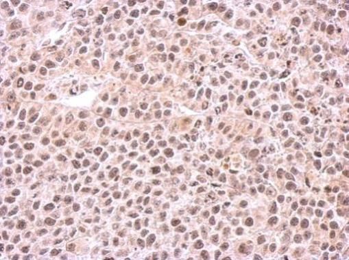 PSMC6 Rabbit Polyclonal Antibody