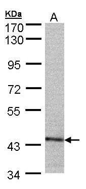 PSMC6 Rabbit Polyclonal Antibody